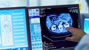 inteligencia artificial en hospitales: ¿ayuda o riesgo?