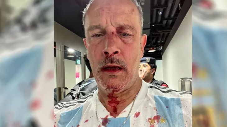 Luis Aguirre - Agredido Qatar.jpg