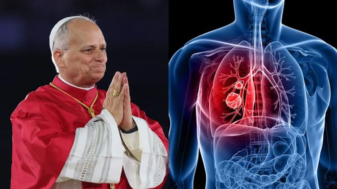 Nuevo parte médico del Papa: evoluciona con normalidad tras la cirugía