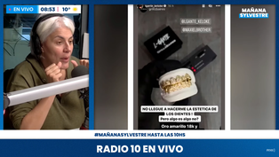 L-Gante mostró su nueva dentadura de oro.